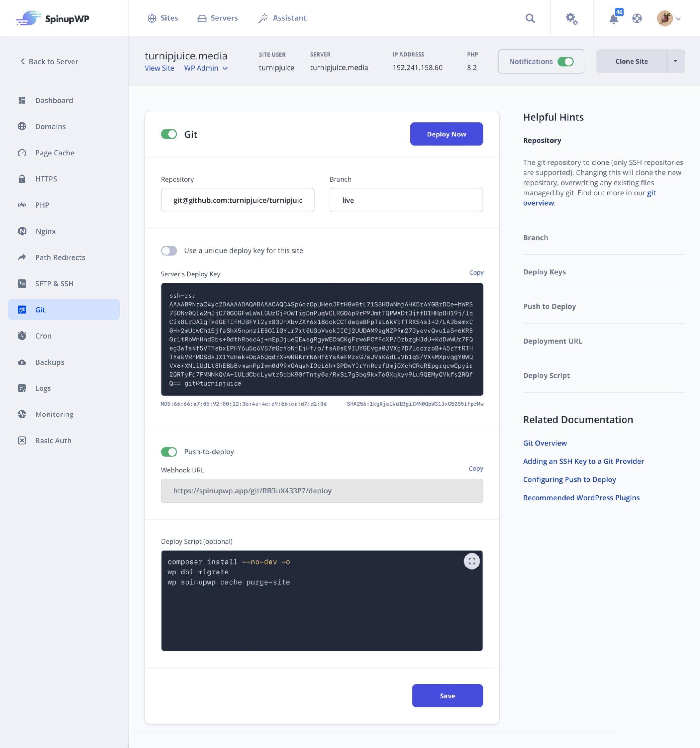 Git Settings in SpinupWP